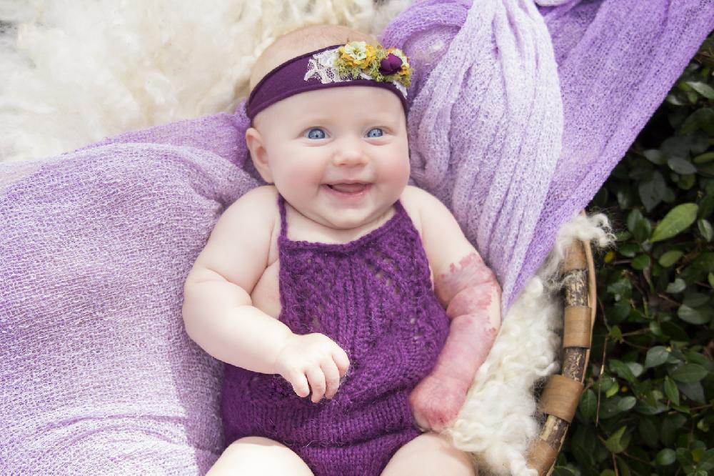 Tulip Romper Sitter Size